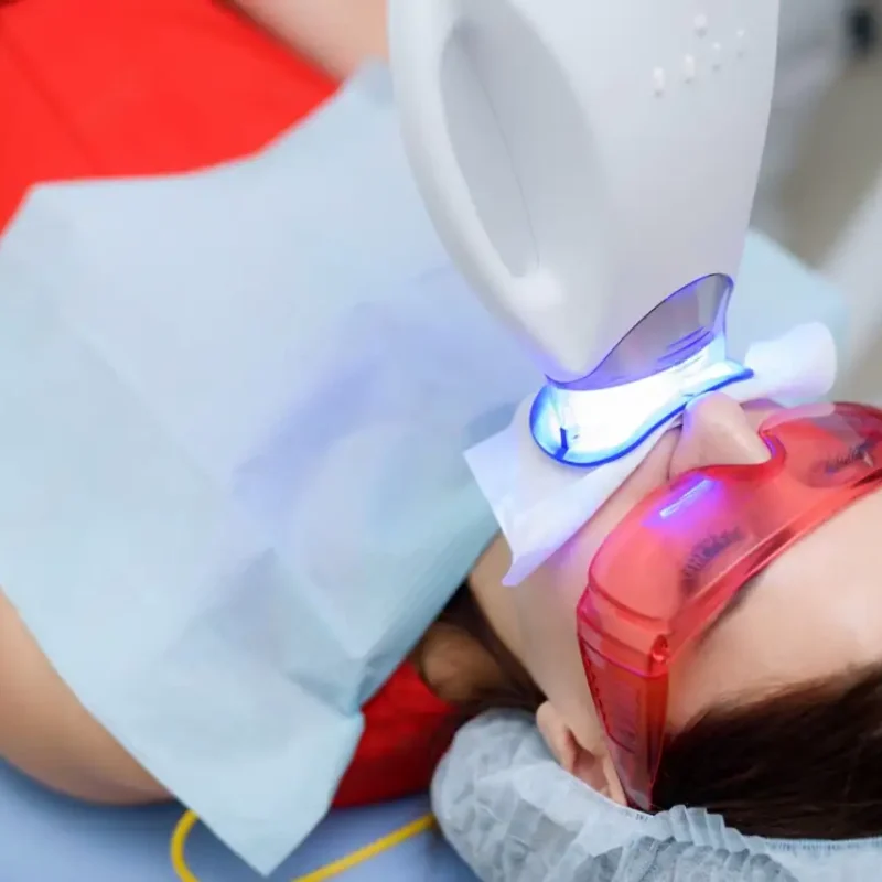Tratamiento de blanqueamiento dental profesional con luz LED en Cuenca
